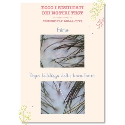 Test sensibilità della cute: prima e dopo l'utilizzo della lozione