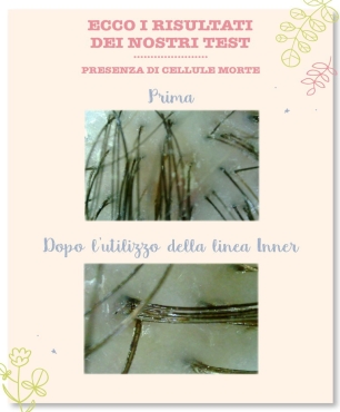 Test purezza della cute: prima e dopo l'utilizzo della lozione