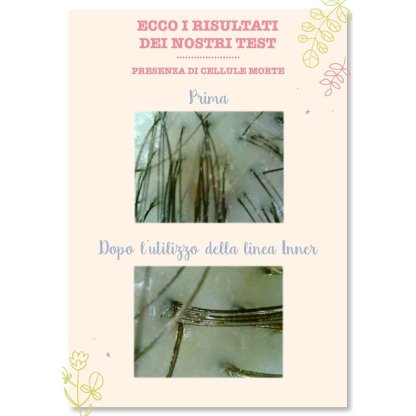 Test purezza della cute: prima e dopo l'utilizzo della lozione