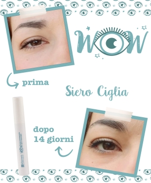 Test siero ciglia: foto prima e dopo l'utilizzo del siero