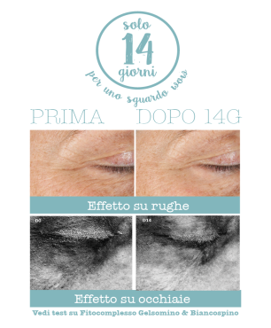 Foto Prima e Dopo 14 giorni di utilizzo della crema su rughe e occhiaie