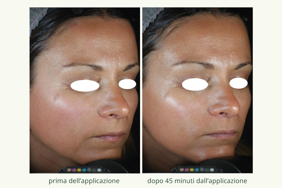 Collagene Vegetale 1