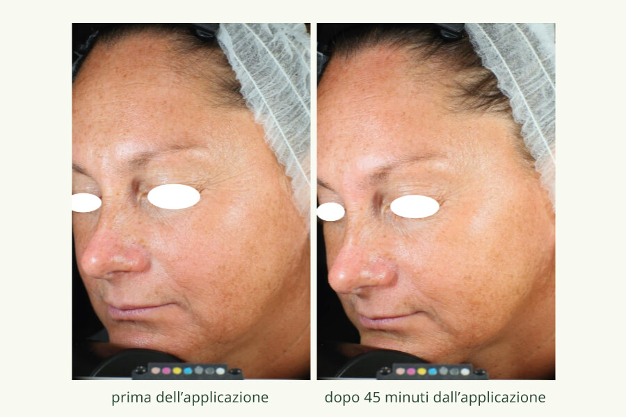 Collagene Vegetale 2