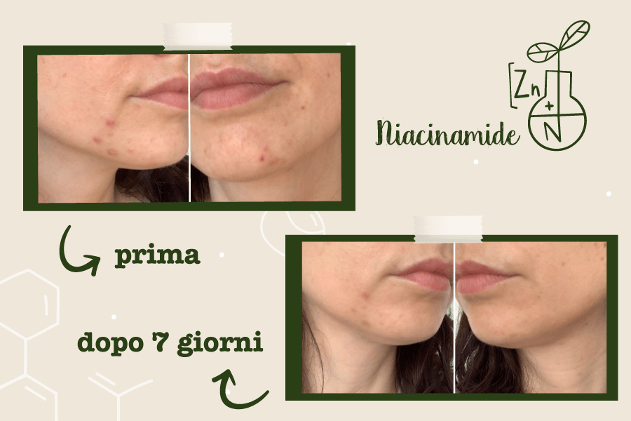 NIACINAMIDE LA SAPONARIA PRIMA DOPO
