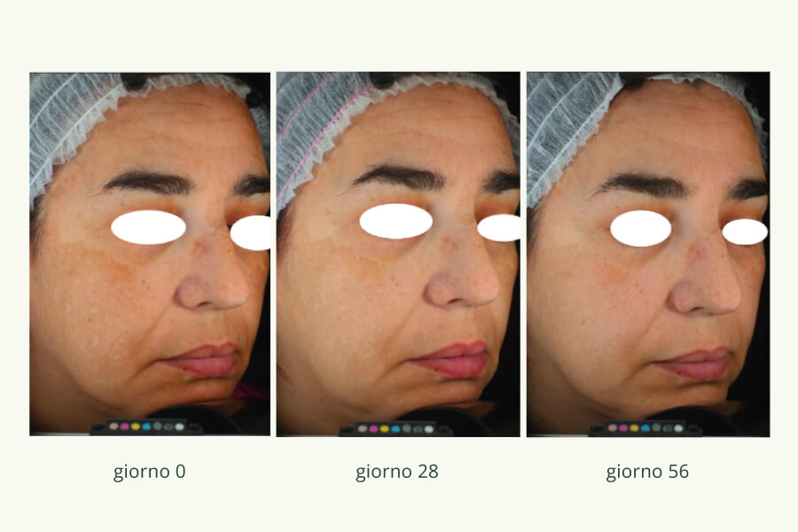 Vitamina C 1