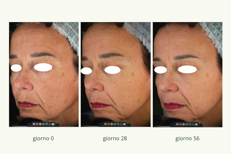 Vitamina C 2