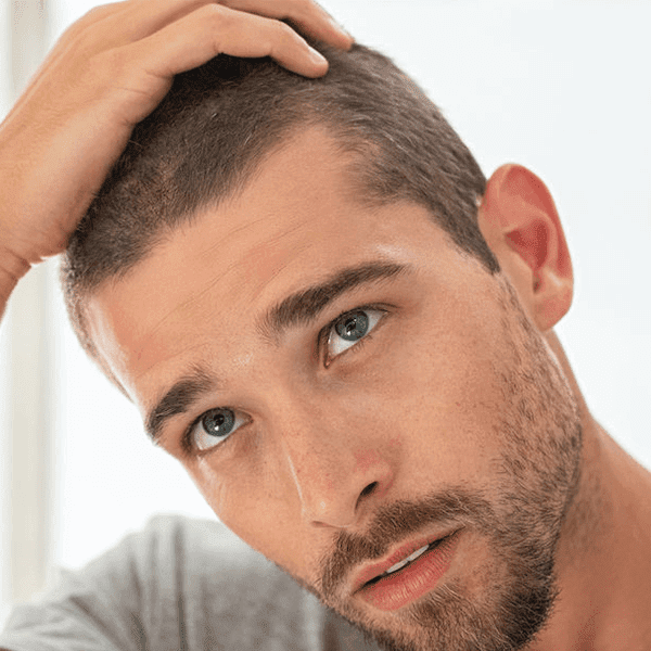 Caduta Capelli 600x600